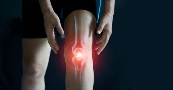 The knee joint is joint joint